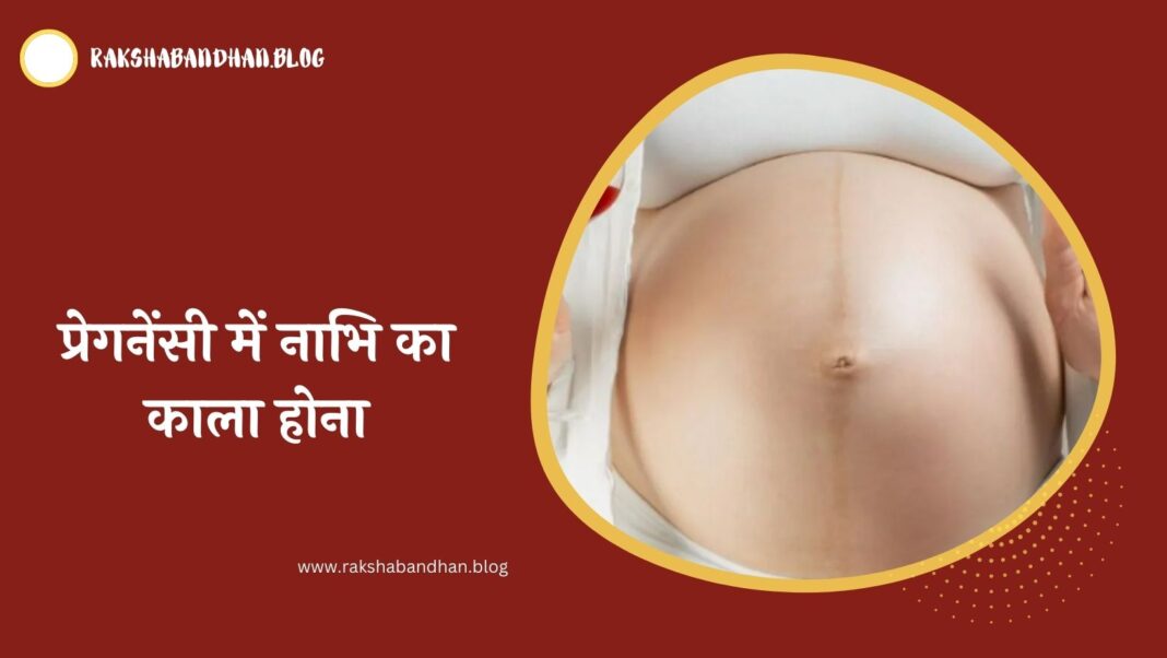 प्रेगनेंसी में नाभि का काला होना (Pregnancy Me Nabhi Ka Kala Hona In Hindi)