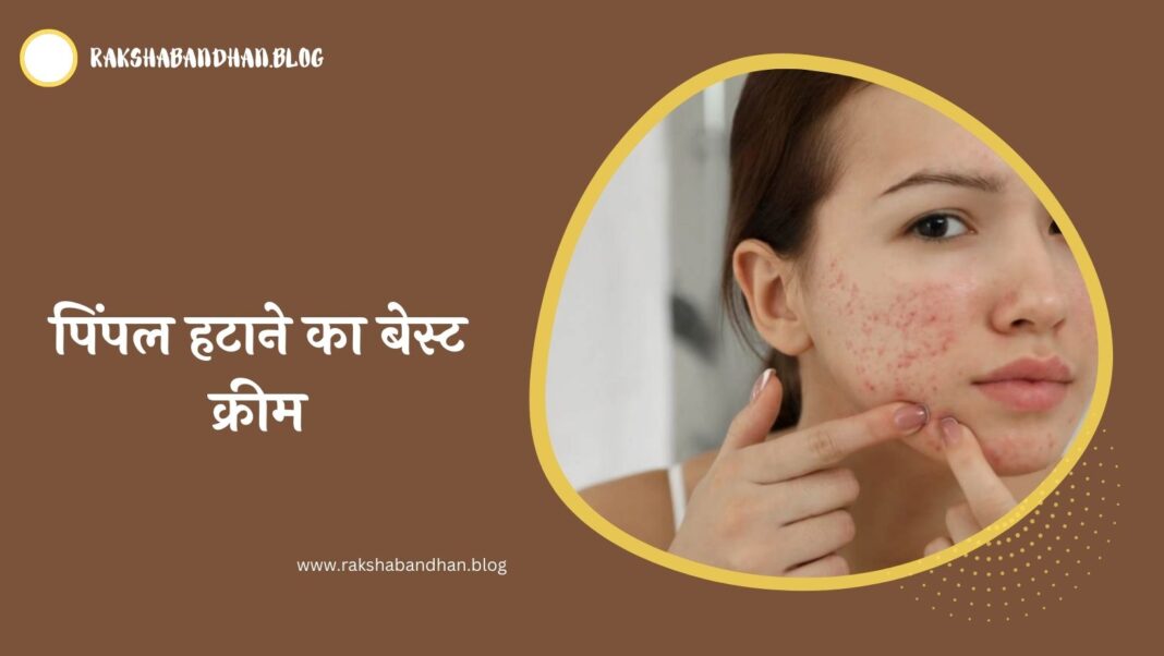 पिंपल हटाने का बेस्ट क्रीम (पिंपल हटाने की क्रीम) - Pimple Ke Liye Best Cream